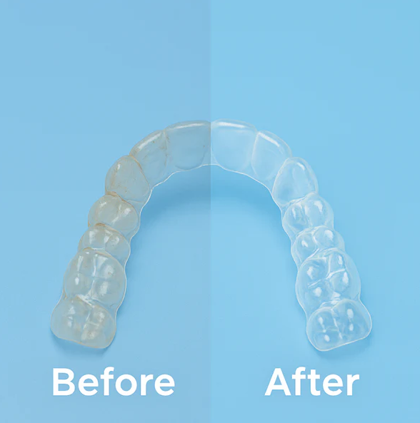 Solución Ultrasonica para Aparatos Dentales iSonic